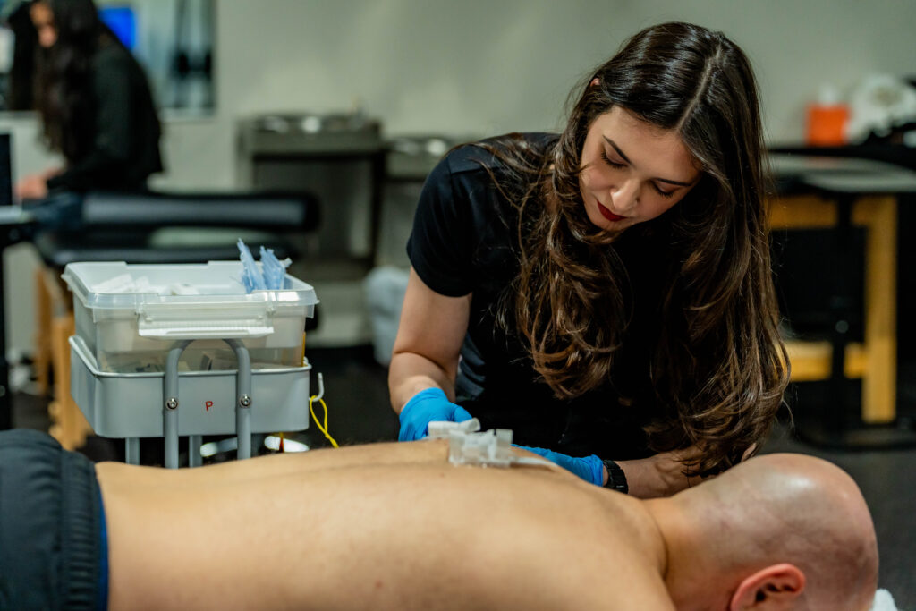 dry needling